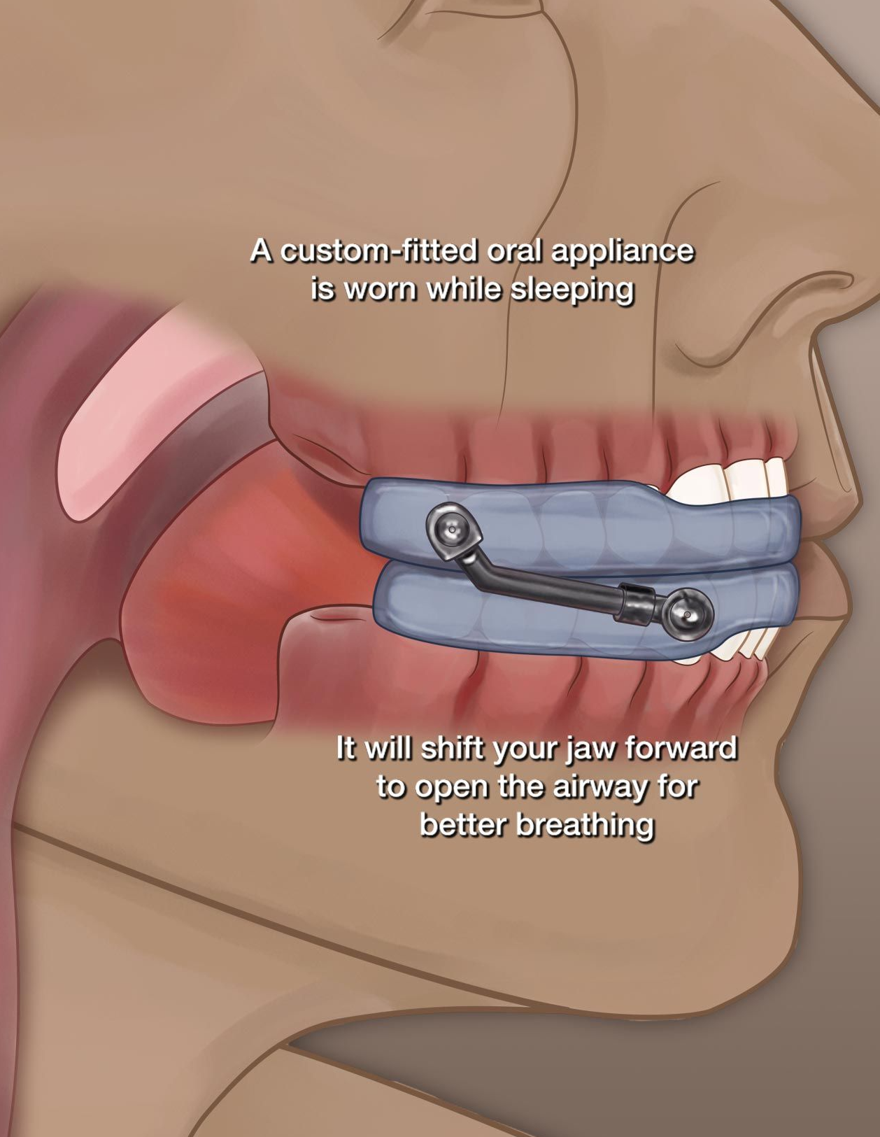sleep apnea hoover al doctor