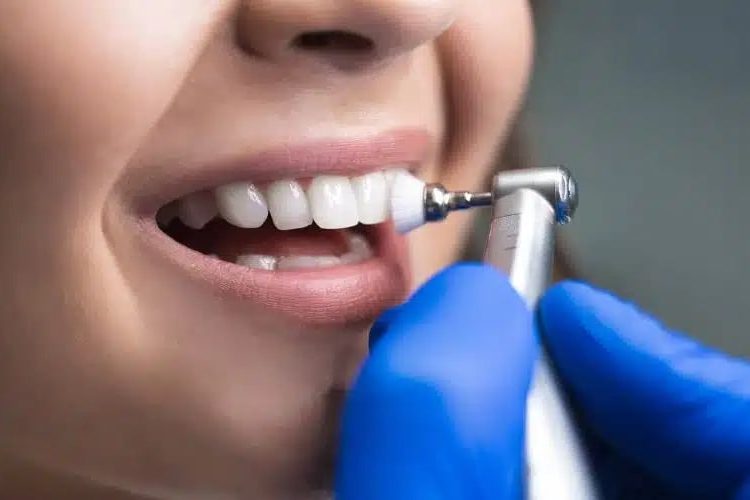 Dental Hygienist at Work- Thorough Teeth Cleaning and Checkups for Hoover, AL Residents