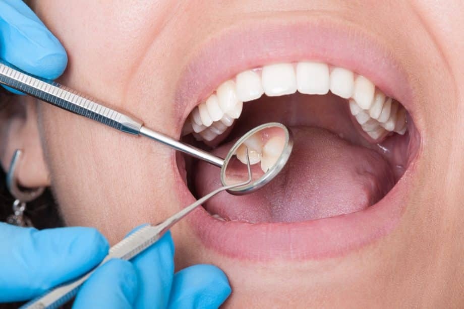 comfortable tooth extraction in bessemer al
