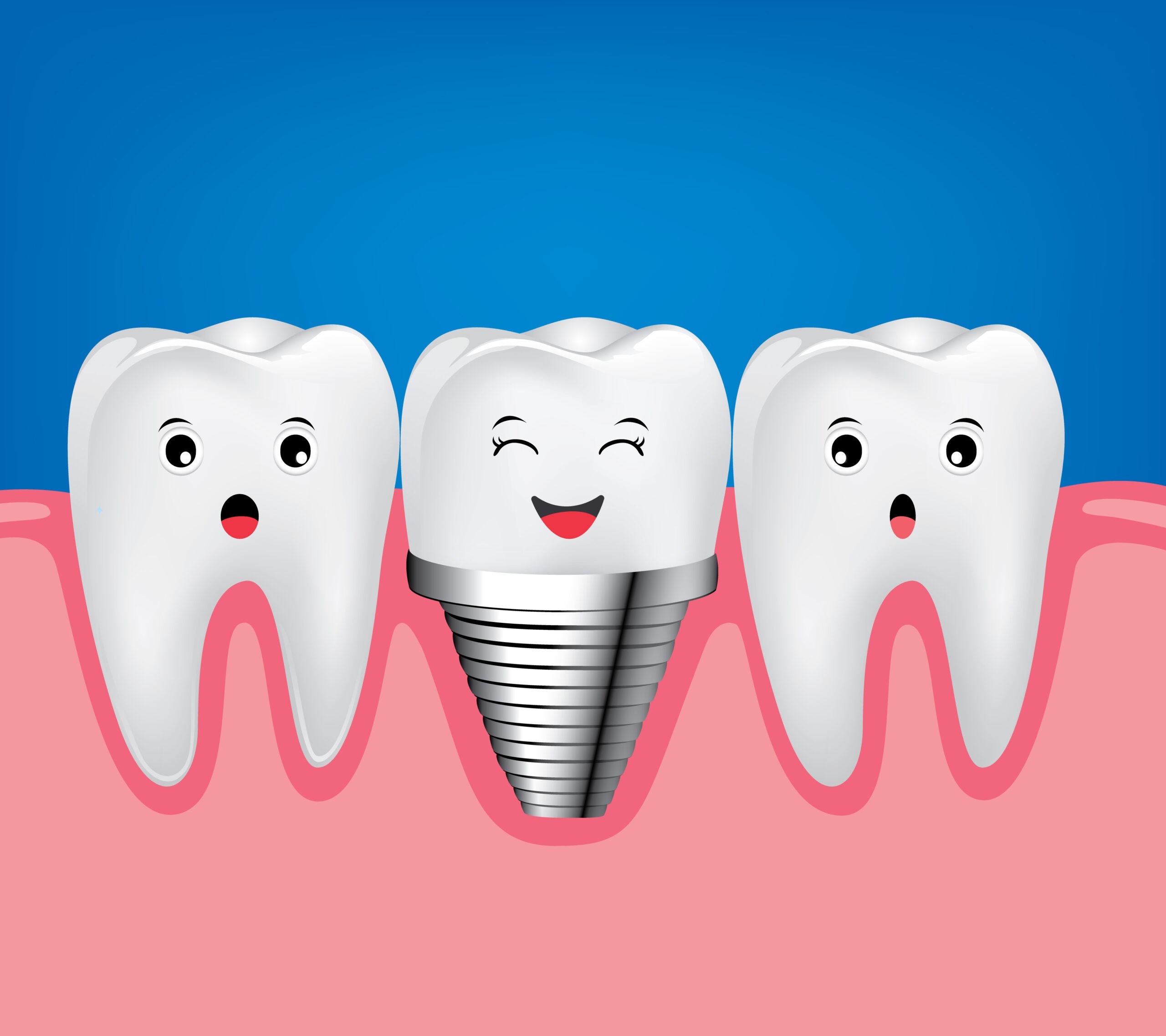 happy smiling dental implants in bessemer al