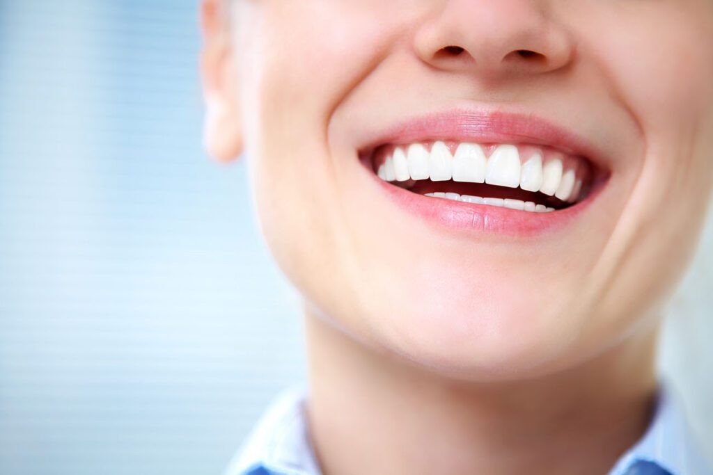 teeth whitening happy patient smiling bessemer al