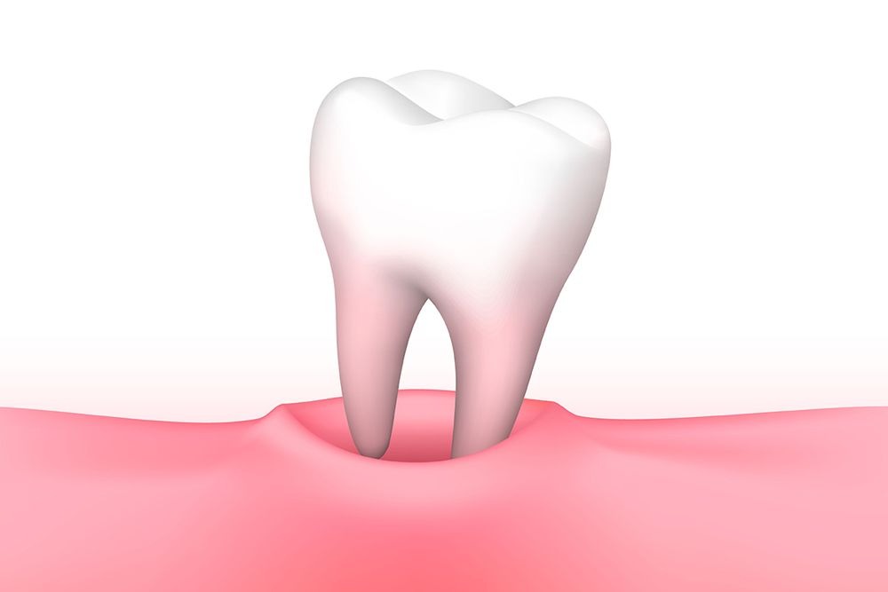 tooth removal in bessemer al